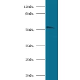 Acetylcholine receptor subunit alpha Polyclonal Antibody from Signalway Antibody (42123) - Antibodies.com