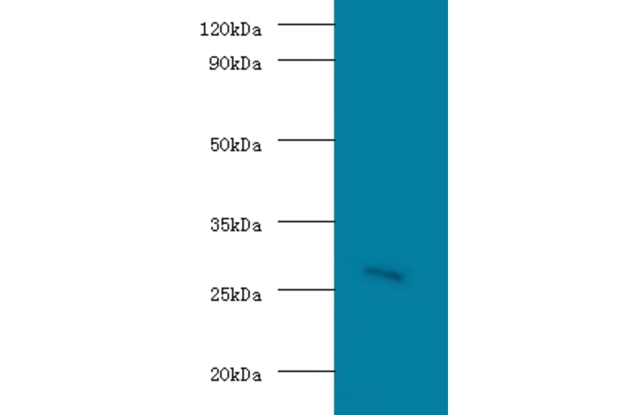 Guanidinoacetate N-methyltransferase Polyclonal Antibody from Signalway Antibody (42175) - Antibodies.com