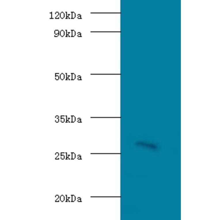 Guanidinoacetate N-methyltransferase Polyclonal Antibody from Signalway Antibody (42175) - Antibodies.com