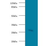 Guanidinoacetate N-methyltransferase Polyclonal Antibody from Signalway Antibody (42175) - Antibodies.com