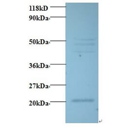 Vascular endothelial growth factor C Polyclonal Antibody from Signalway Antibody (42489) - Antibodies.com