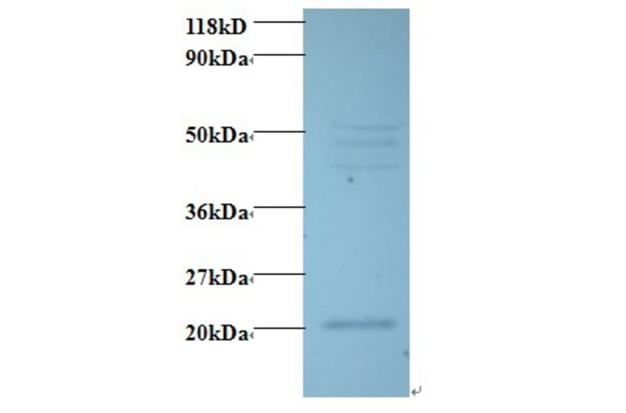 Vascular endothelial growth factor C Polyclonal Antibody from Signalway Antibody (42489) - Antibodies.com