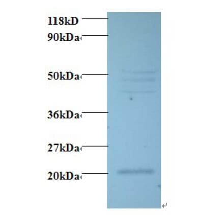 Vascular endothelial growth factor C Polyclonal Antibody from Signalway Antibody (42489) - Antibodies.com
