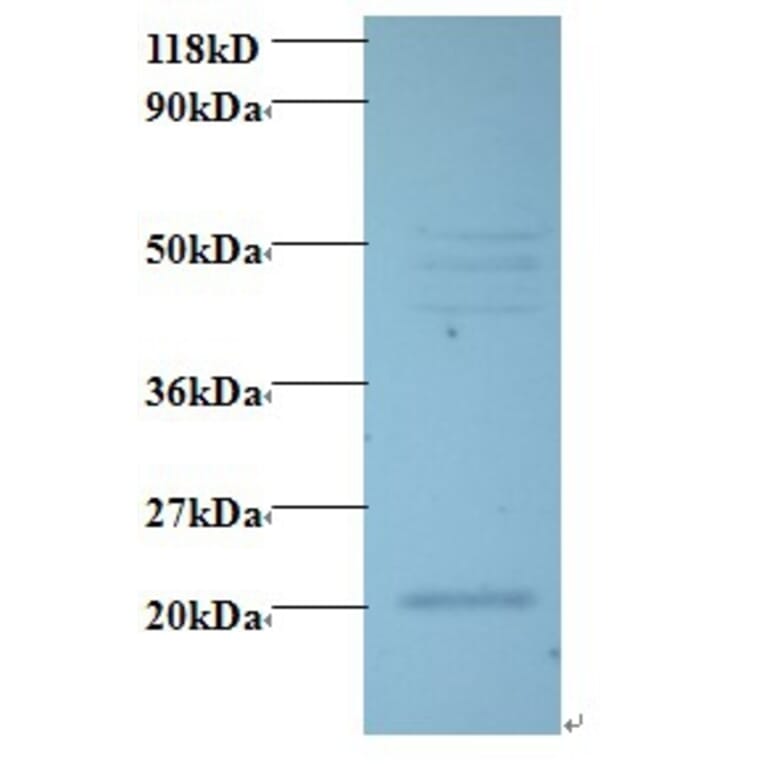 Vascular endothelial growth factor C Polyclonal Antibody from Signalway Antibody (42489) - Antibodies.com