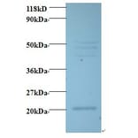 Vascular endothelial growth factor C Polyclonal Antibody from Signalway Antibody (42489) - Antibodies.com