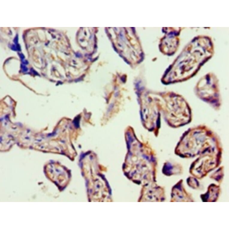 Immunohistochemistry - Vascular endothelial growth factor C Polyclonal Antibody from Signalway Antibody (42489)