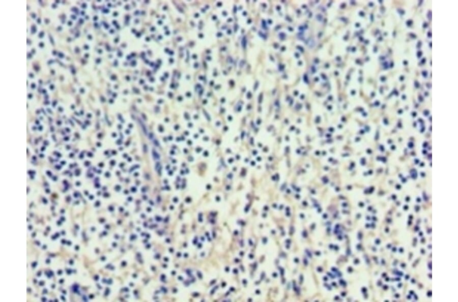 Immunohistochemistry - Vascular endothelial growth factor C Polyclonal Antibody from Signalway Antibody (42489)