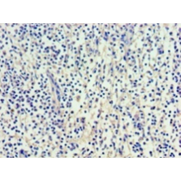 Immunohistochemistry - Vascular endothelial growth factor C Polyclonal Antibody from Signalway Antibody (42489)