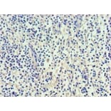 Immunohistochemistry - Vascular endothelial growth factor C Polyclonal Antibody from Signalway Antibody (42489)