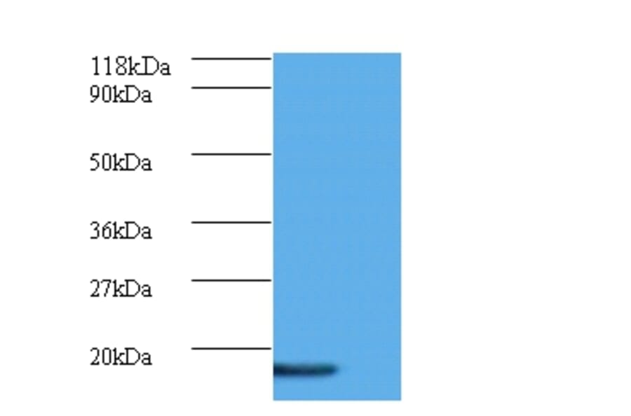 AP-1 complex subunit sigma-3 Polyclonal Antibody from Signalway Antibody (42067) - Antibodies.com