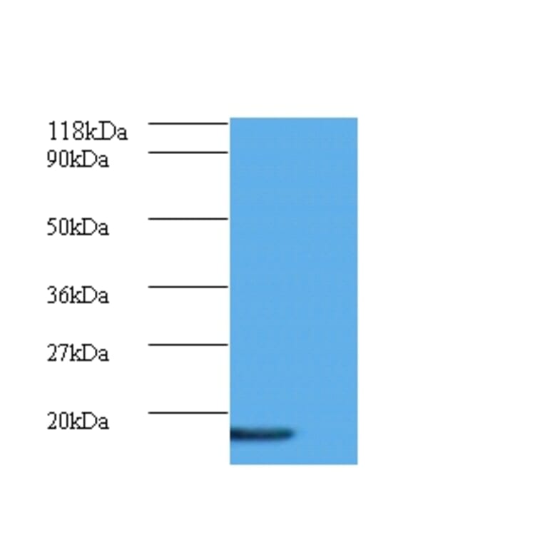 AP-1 complex subunit sigma-3 Polyclonal Antibody from Signalway Antibody (42067) - Antibodies.com