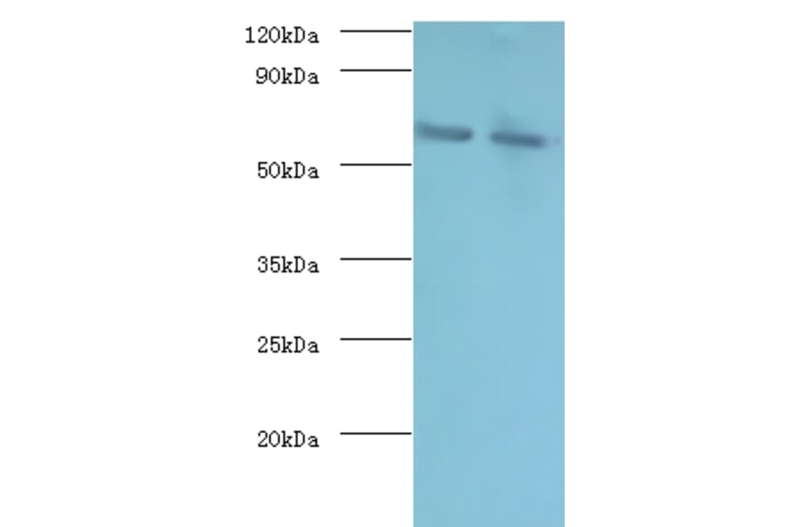 Negative elongation factor B Polyclonal Antibody from Signalway Antibody (42401) - Antibodies.com