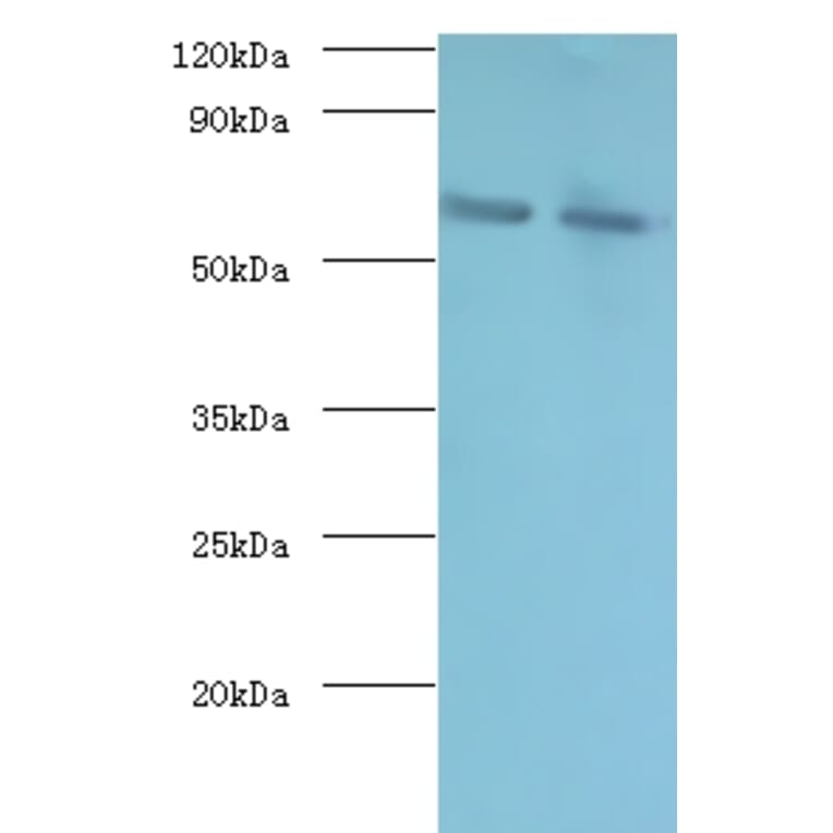 Negative elongation factor B Polyclonal Antibody from Signalway Antibody (42401) - Antibodies.com