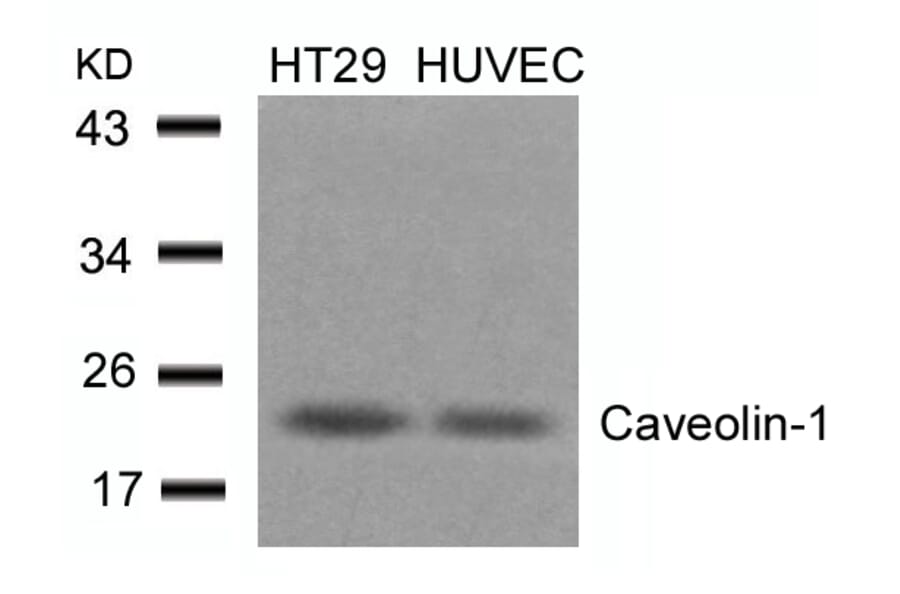 Western blot - Caveolin-1 (Ab-14) Antibody from Signalway Antibody (21112) - Antibodies.com