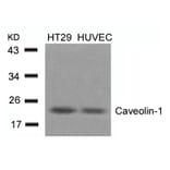 Western blot - Caveolin-1 (Ab-14) Antibody from Signalway Antibody (21112) - Antibodies.com