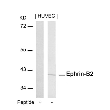 Western blot - Ephrin-B2 (Ab-316) Antibody from Signalway Antibody (21195) - Antibodies.com