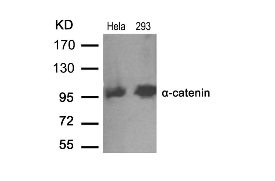 Western blot - a-catenin (Ab-641) Antibody from Signalway Antibody (21330) - Antibodies.com