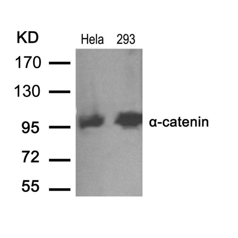 Western blot - a-catenin (Ab-641) Antibody from Signalway Antibody (21330) - Antibodies.com