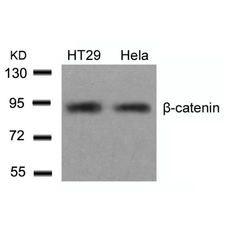 Western blot - b-Catenin (Ab-654) Antibody from Signalway Antibody (21520) - Antibodies.com