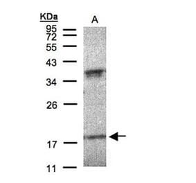 Interferon alpha-6 antibody from Signalway Antibody (22059) - Antibodies.com