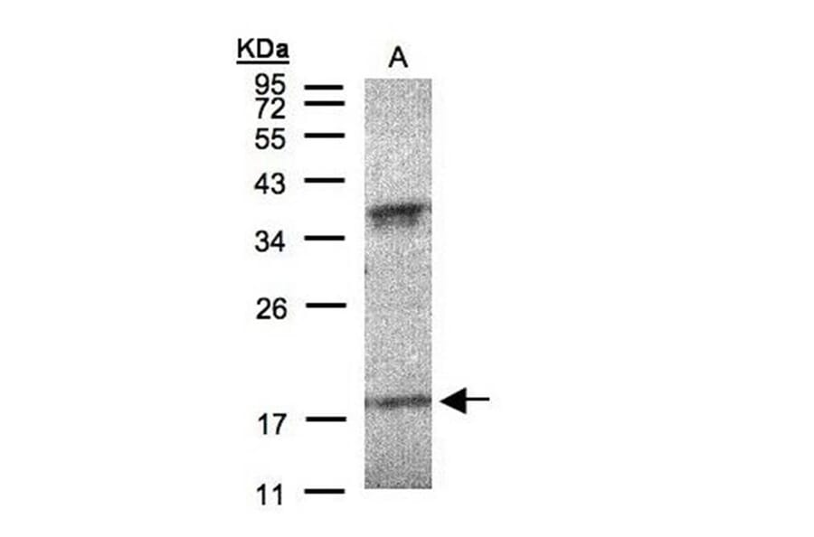 Interferon alpha-6 antibody from Signalway Antibody (22059) - Antibodies.com