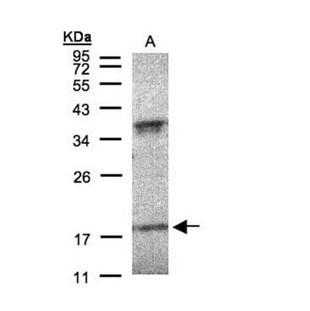 Interferon alpha-6 antibody from Signalway Antibody (22059) - Antibodies.com