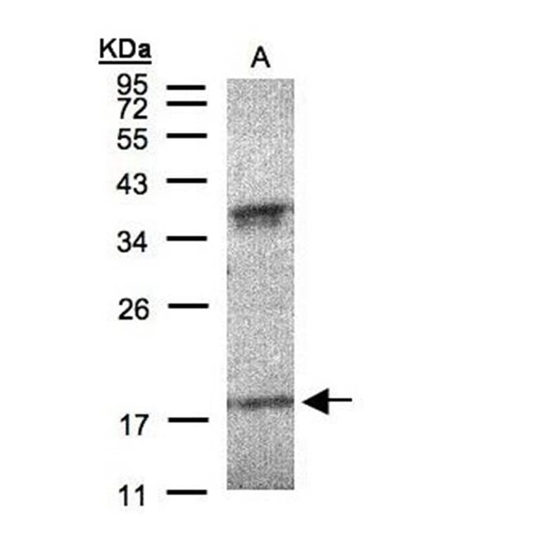 Interferon alpha-6 antibody from Signalway Antibody (22059) - Antibodies.com