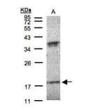 Interferon alpha-6 antibody from Signalway Antibody (22059) - Antibodies.com