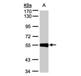 Carboxypeptidase M antibody from Signalway Antibody (22407) - Antibodies.com