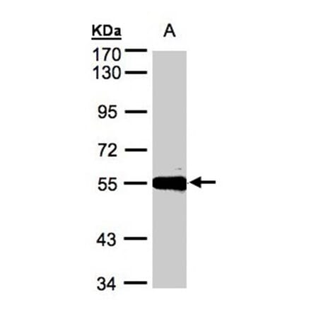 Carboxypeptidase M antibody from Signalway Antibody (22407) - Antibodies.com