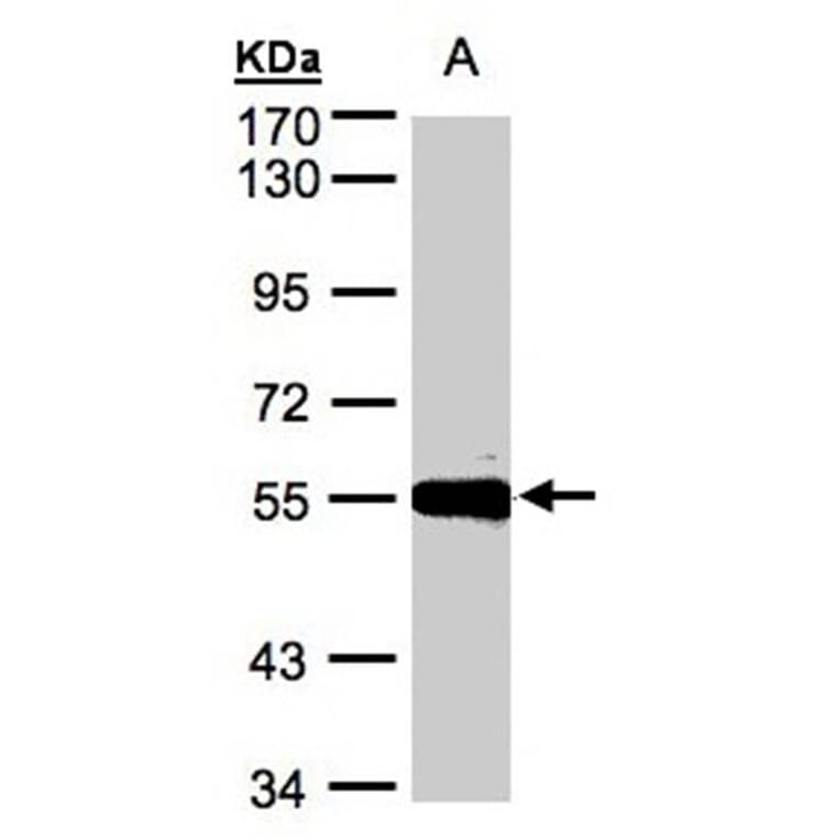 Carboxypeptidase M antibody from Signalway Antibody (22407) - Antibodies.com