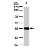 Carboxypeptidase M antibody from Signalway Antibody (22407) - Antibodies.com