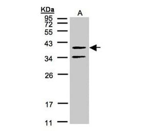 galanin receptor 2 antibody from Signalway Antibody (22465) - Antibodies.com