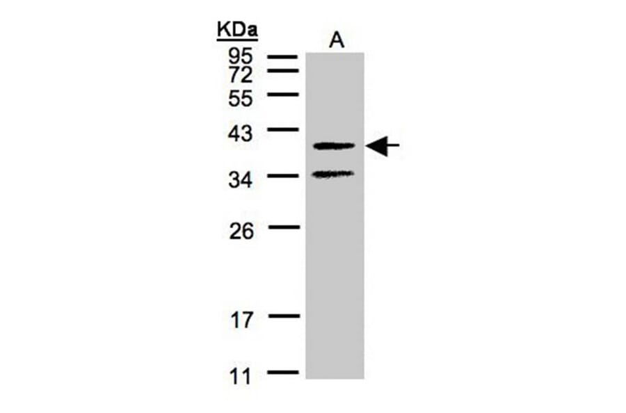 galanin receptor 2 antibody from Signalway Antibody (22465) - Antibodies.com