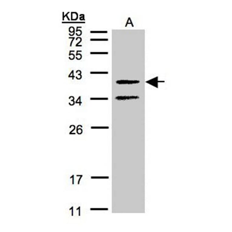 galanin receptor 2 antibody from Signalway Antibody (22465) - Antibodies.com