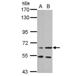 prolactin receptor antibody from Signalway Antibody (22526) - Antibodies.com