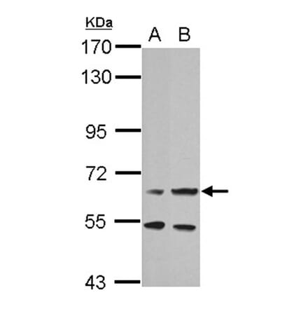 prolactin receptor antibody from Signalway Antibody (22526) - Antibodies.com