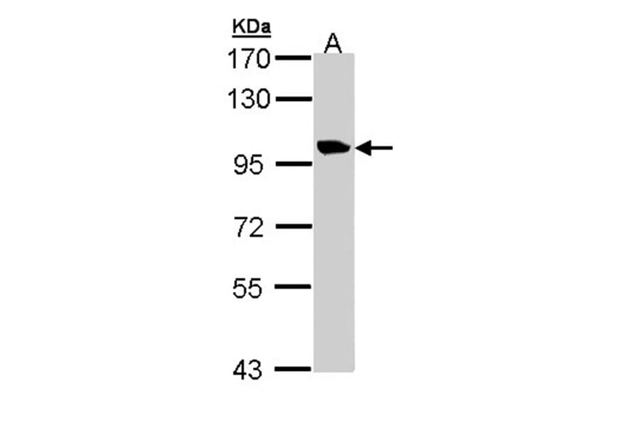 meckelin isoform 1 antibody from Signalway Antibody (22668) - Antibodies.com