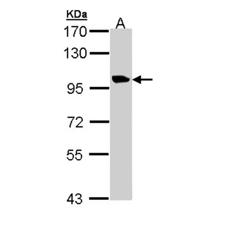 meckelin isoform 1 antibody from Signalway Antibody (22668) - Antibodies.com