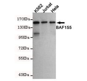 Western blot - SMARCC1 Monoclonal Antibody from Signalway Antibody (27185) - Antibodies.com