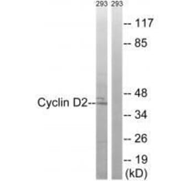 Western blot - Cyclin D2 (Ab-280) Antibody from Signalway Antibody (33283) - Antibodies.com