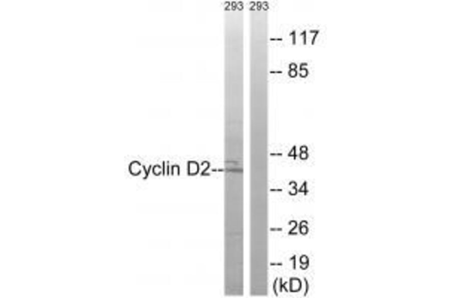 Western blot - Cyclin D2 (Ab-280) Antibody from Signalway Antibody (33283) - Antibodies.com