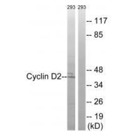 Western blot - Cyclin D2 (Ab-280) Antibody from Signalway Antibody (33283) - Antibodies.com