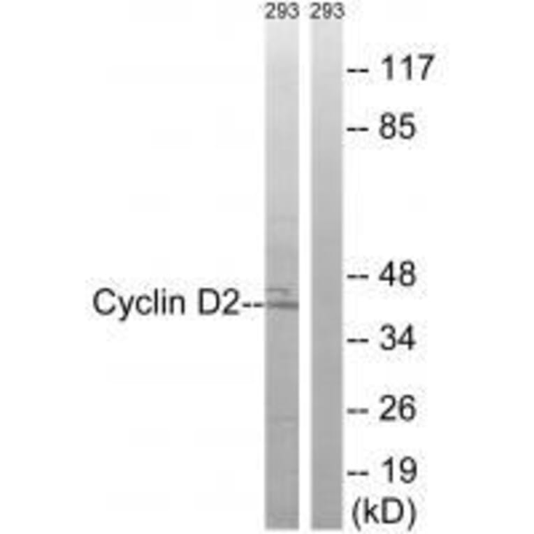 Western blot - Cyclin D2 (Ab-280) Antibody from Signalway Antibody (33283) - Antibodies.com