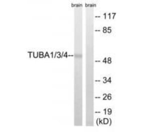 Western blot - TUBA1/3/4 (Ab-272) Antibody from Signalway Antibody (33306) - Antibodies.com
