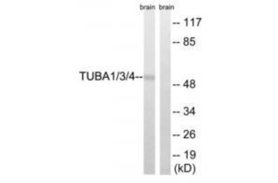 Western blot - TUBA1/3/4 (Ab-272) Antibody from Signalway Antibody (33306) - Antibodies.com