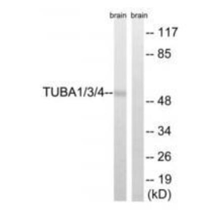 Western blot - TUBA1/3/4 (Ab-272) Antibody from Signalway Antibody (33306) - Antibodies.com