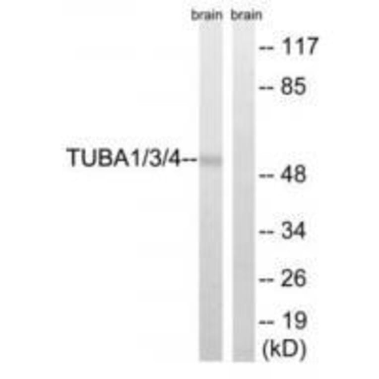 Western blot - TUBA1/3/4 (Ab-272) Antibody from Signalway Antibody (33306) - Antibodies.com