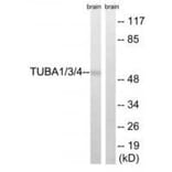 Western blot - TUBA1/3/4 (Ab-272) Antibody from Signalway Antibody (33306) - Antibodies.com