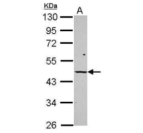 Vitamin D Receptor Antibody from Signalway Antibody (35519) - Antibodies.com